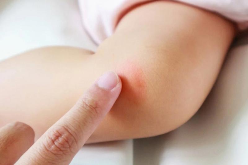 Hướng dẫn chi tiết cách bôi tinh dầu chống muỗi Ông Tiên an toàn cho bé nhỏ